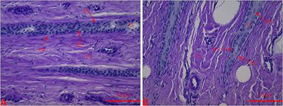 Change in Proteolytic Profile in Heifers After Oligofructose Overload